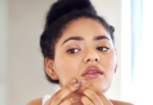 What Is Maskne? How to Fight Breakouts Caused By Wearing a Mask